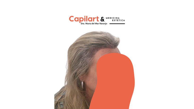 Consulta de medicina estética de Capilart