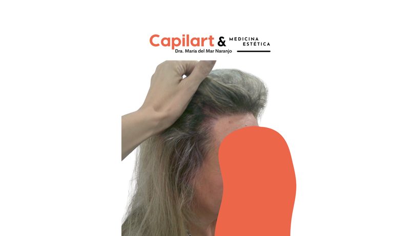 Sesión de tratamiento capilar en Capilart